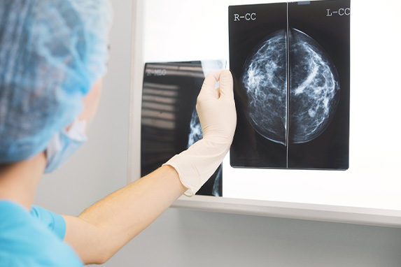 Frau in Chirurgie-Outfit hält ein Mammogramm vor Röntgenstrahler