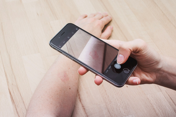 Bildausschnitt: eine Hand fotografiert mit dem Smartphone einen Hautausschlag an einem Arm